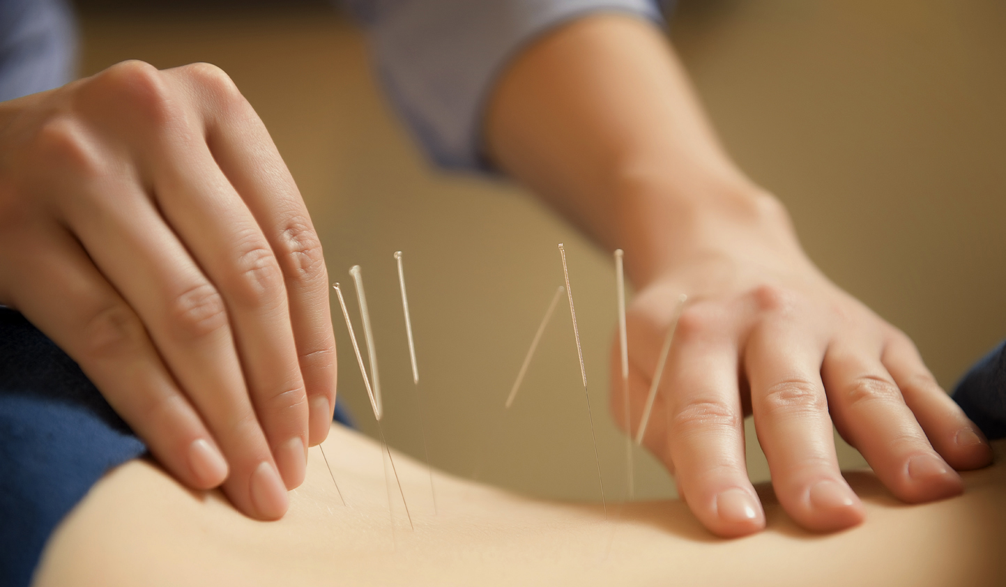 Acupuncture at Glory of Mercy TCM Clinic